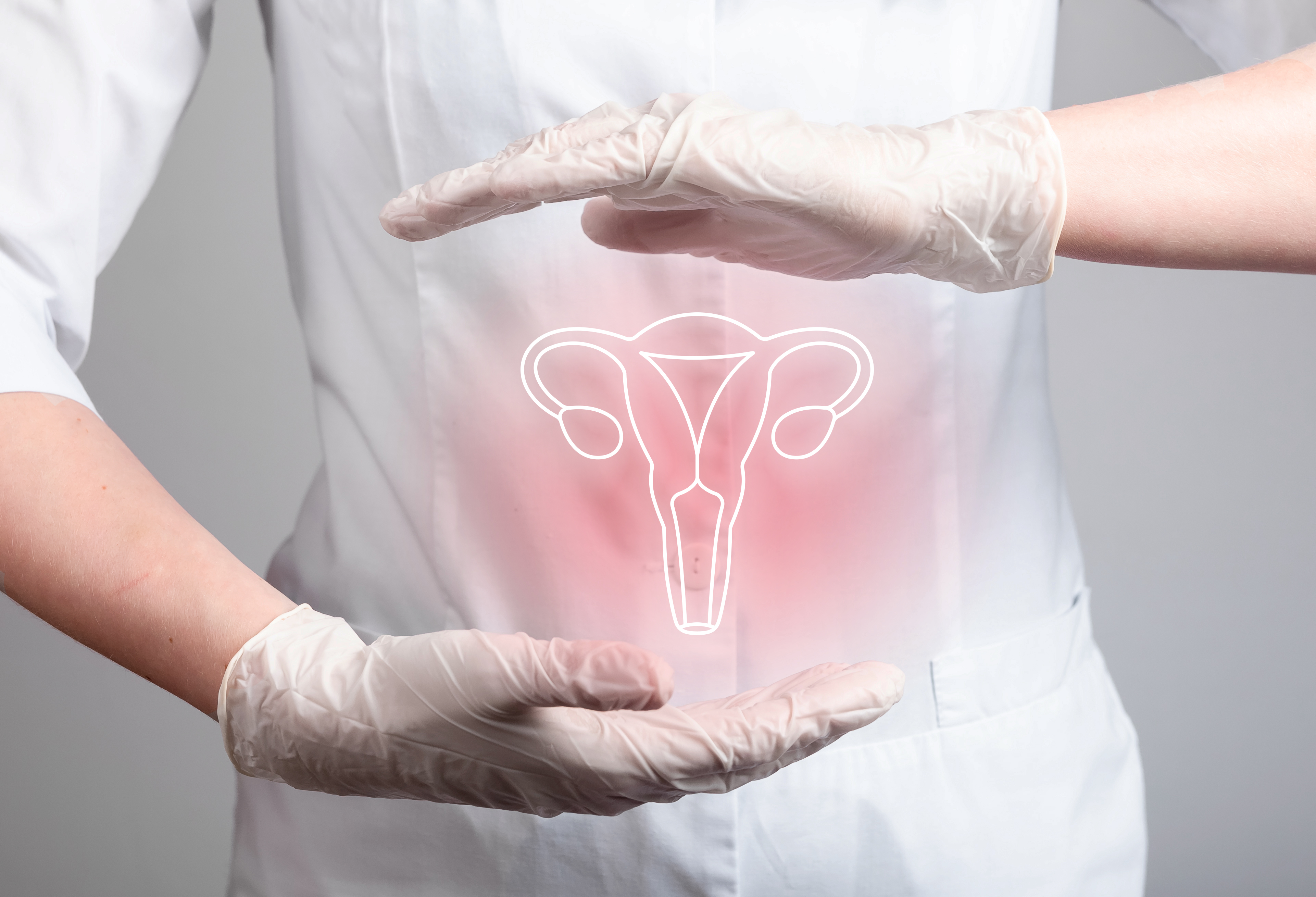 Endometriosis